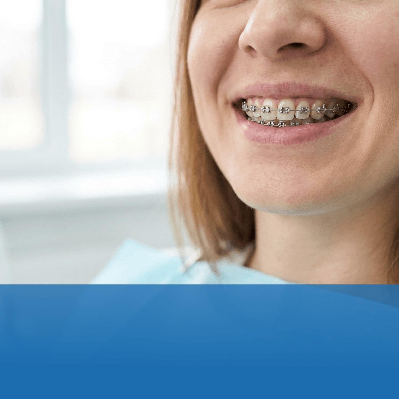 Close-up of a person smiling with metal braces on upper and lower teeth.