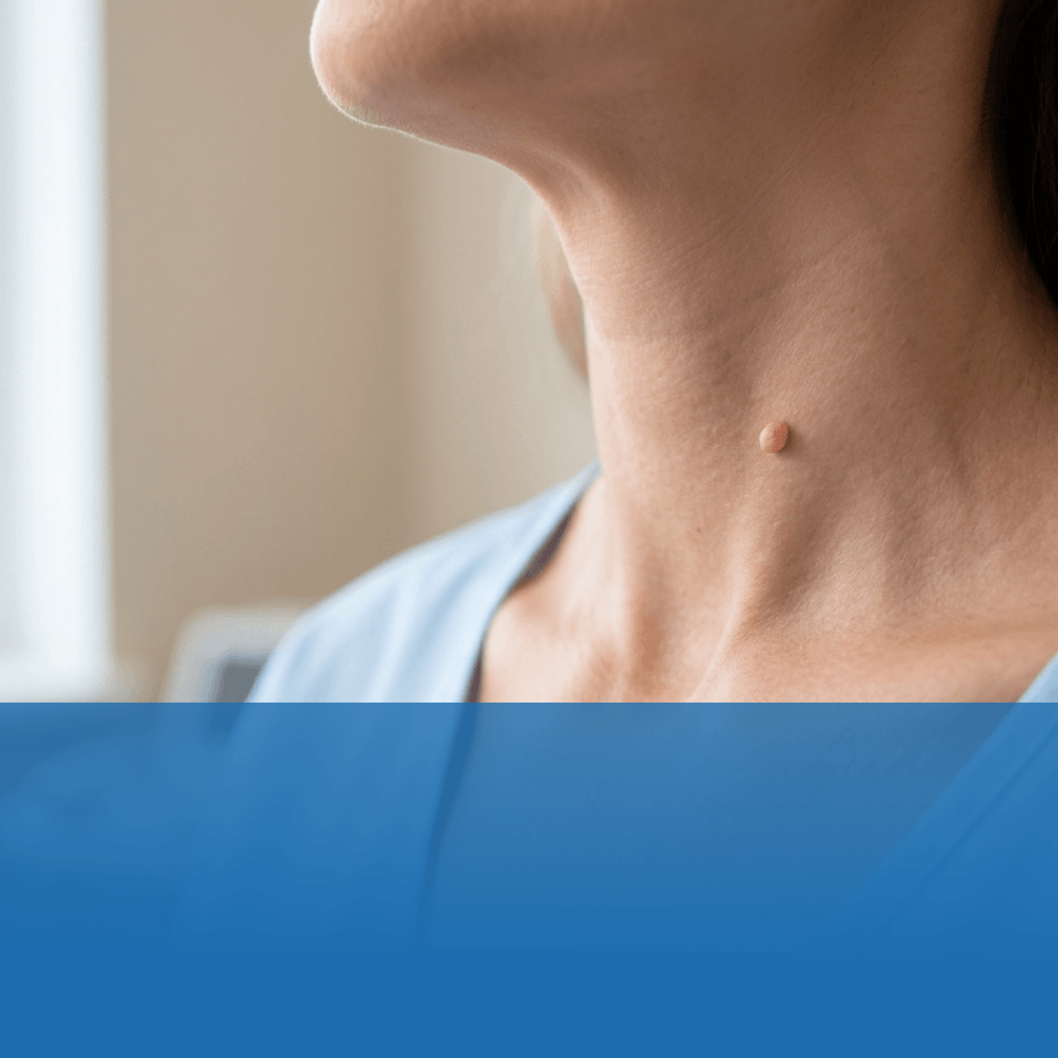 Close-up of a person’s neck in profile, showing a small raised mole on the left side. A blue garment is visible and a blue overlay bar covers the lower portion of the image.