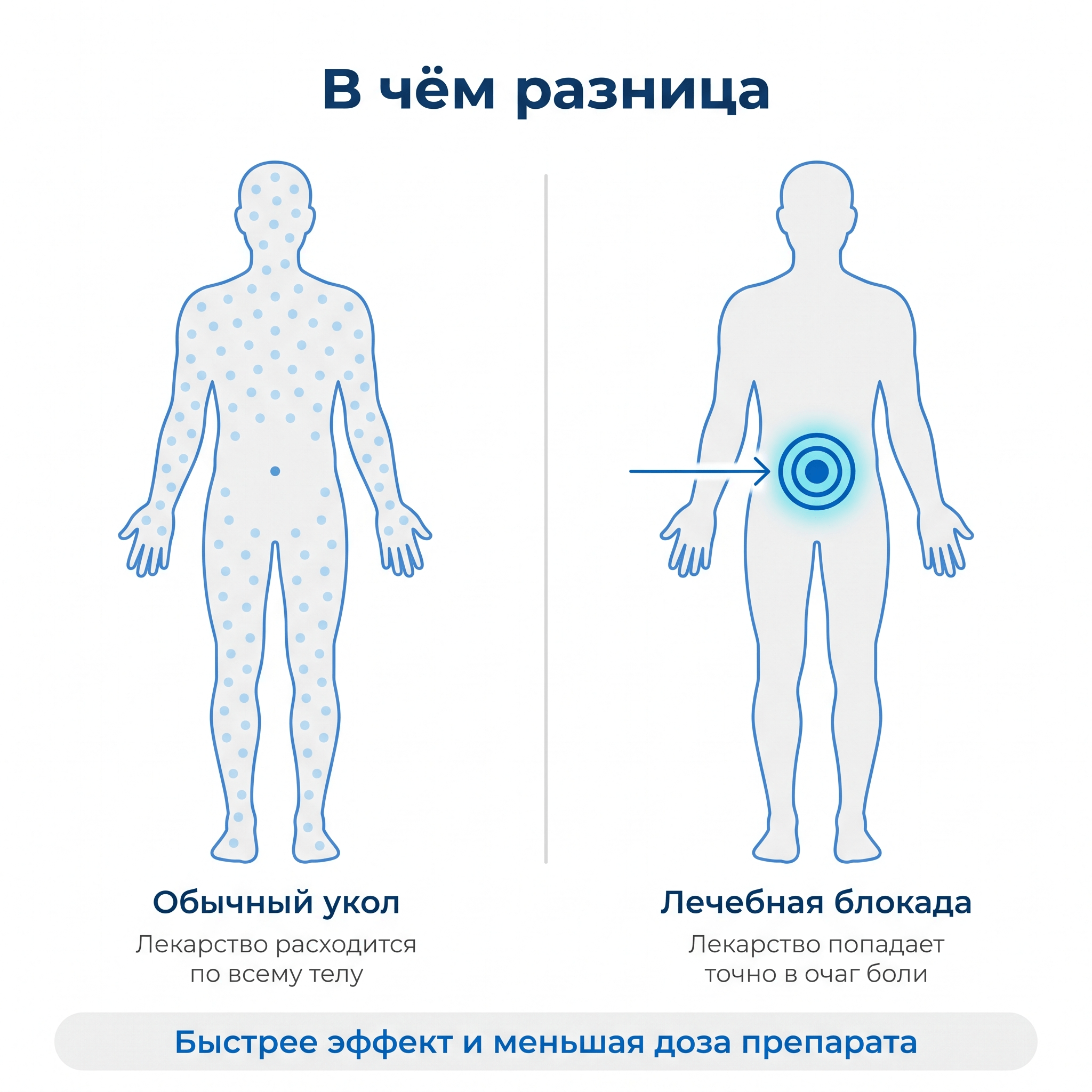 Что такое лечебная блокада простыми словами