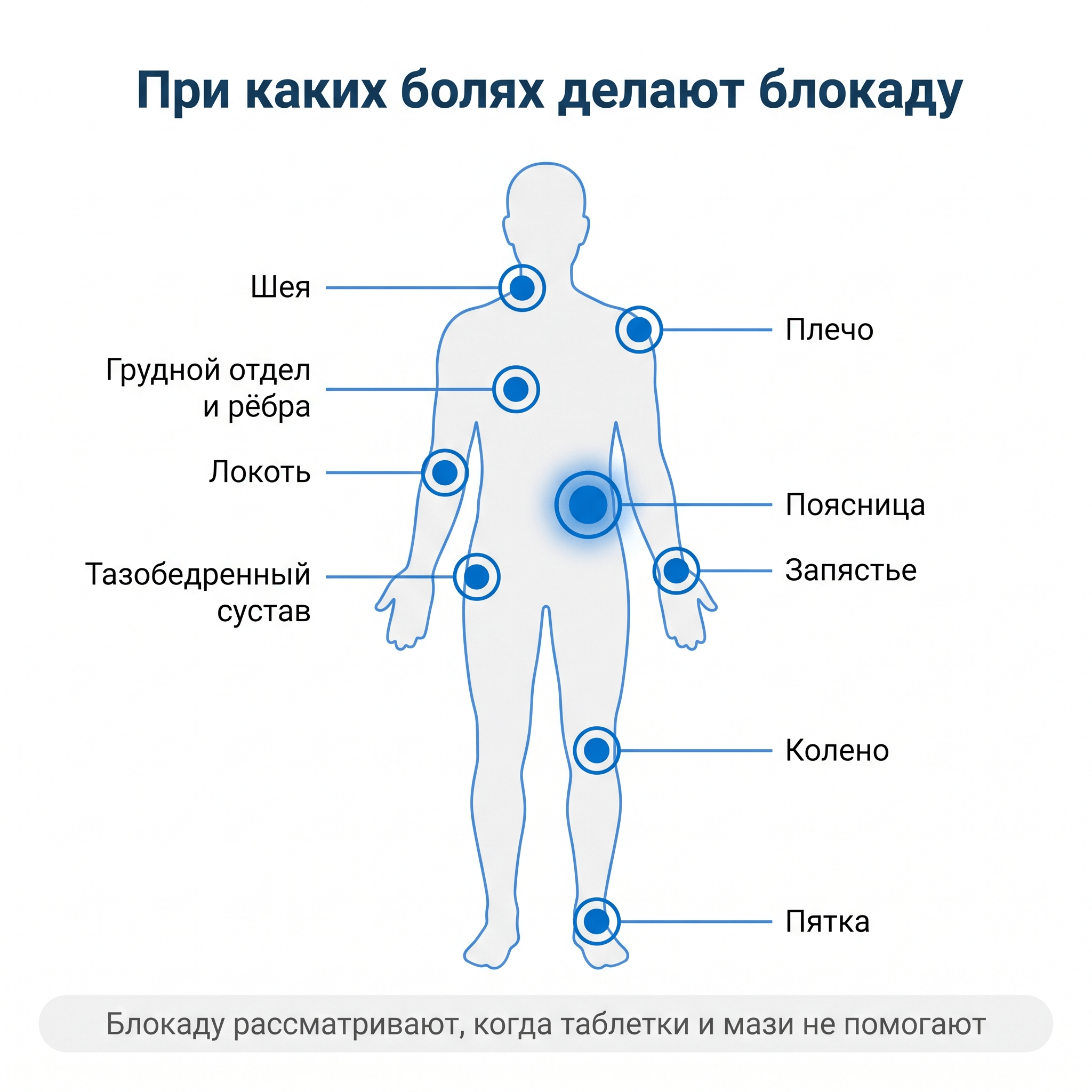 При каких болях делают лечебную блокаду — показания