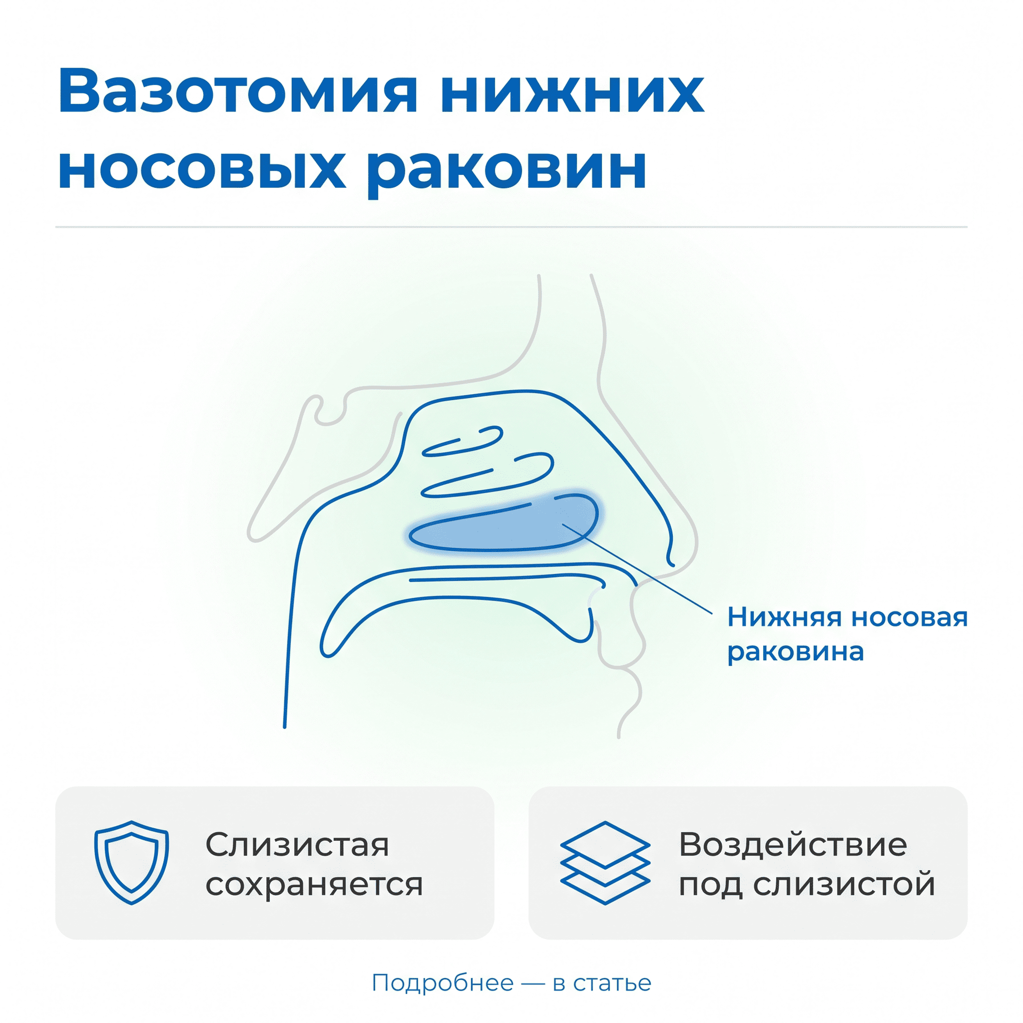 вазотомия нижних носовых раковин в Подольске